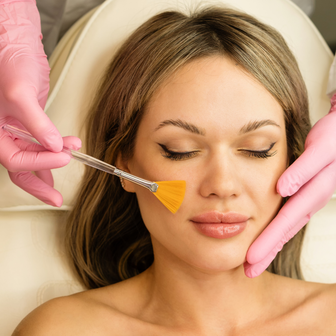 Yellow Peel